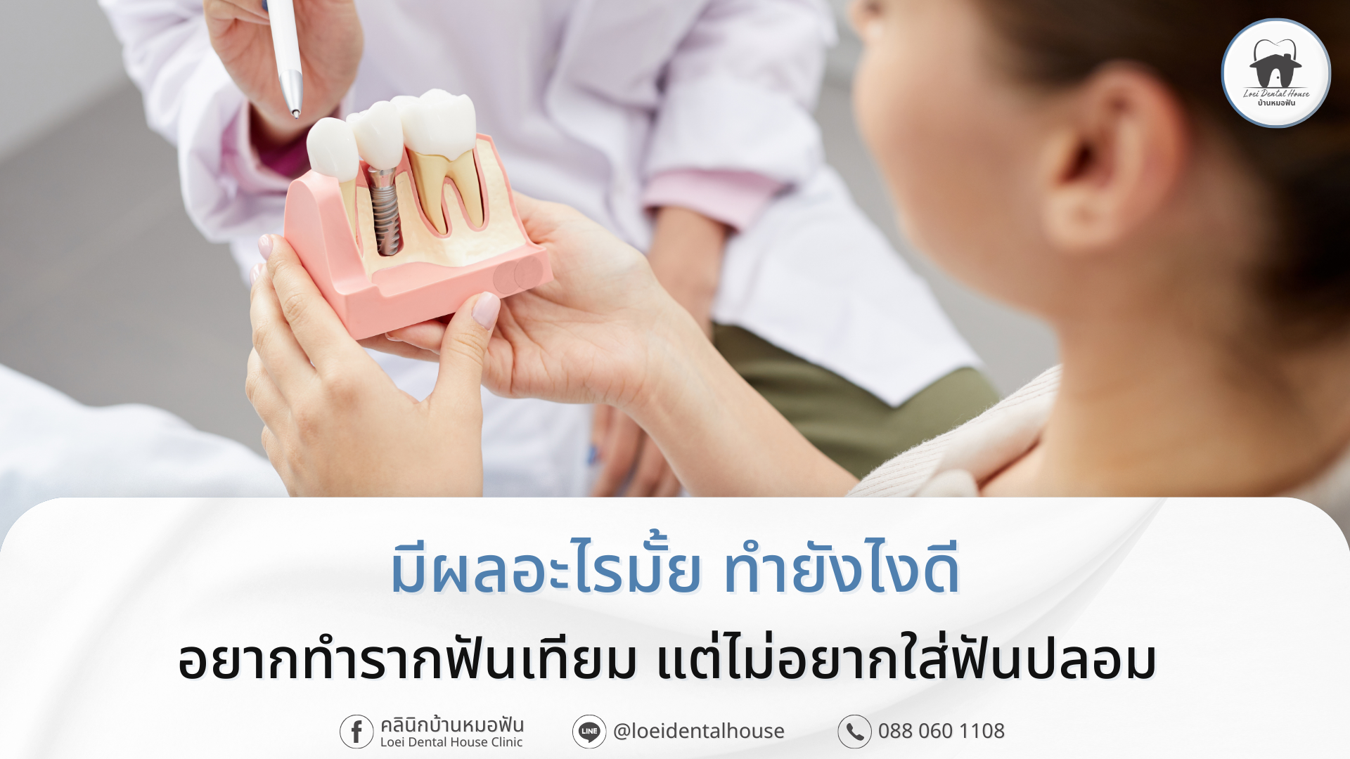 อยากทำรากฟันเทียม แต่ไม่อยากใส่ฟันปลอม มีผลอะไรมั้ย? ทำยังไงดี?