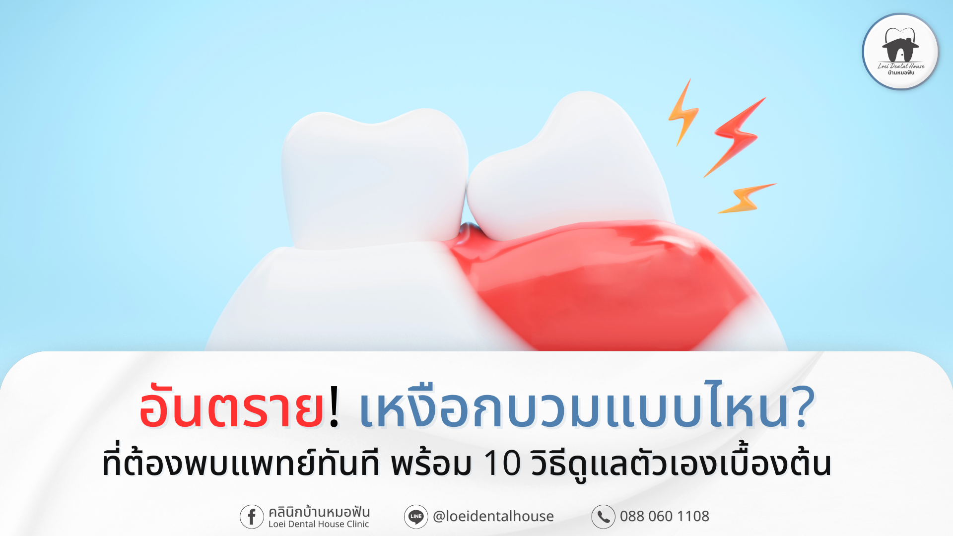 อันตราย! เหงือกบวมแบบไหน_ ที่ต้องพบแพทย์ทันที พร้อม 10 วิธีดูแลตัวเองเบื้องต้น