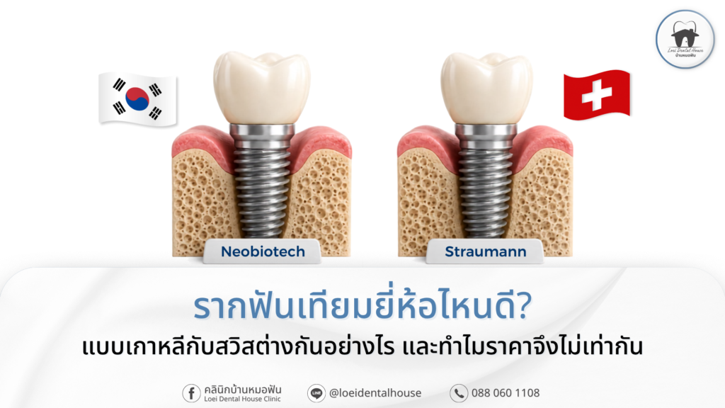รากฟันเทียมสวิส Straumannรากฟันเทียมยี่ห้อไหนดี แบบเกาหลีกับสวิสต่างกันอย่างไร และทำไมราคาจึงไม่เท่ากัน
