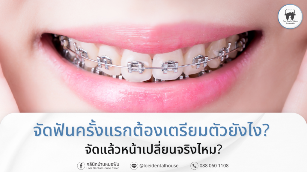 จัดฟัน เมืองเลย