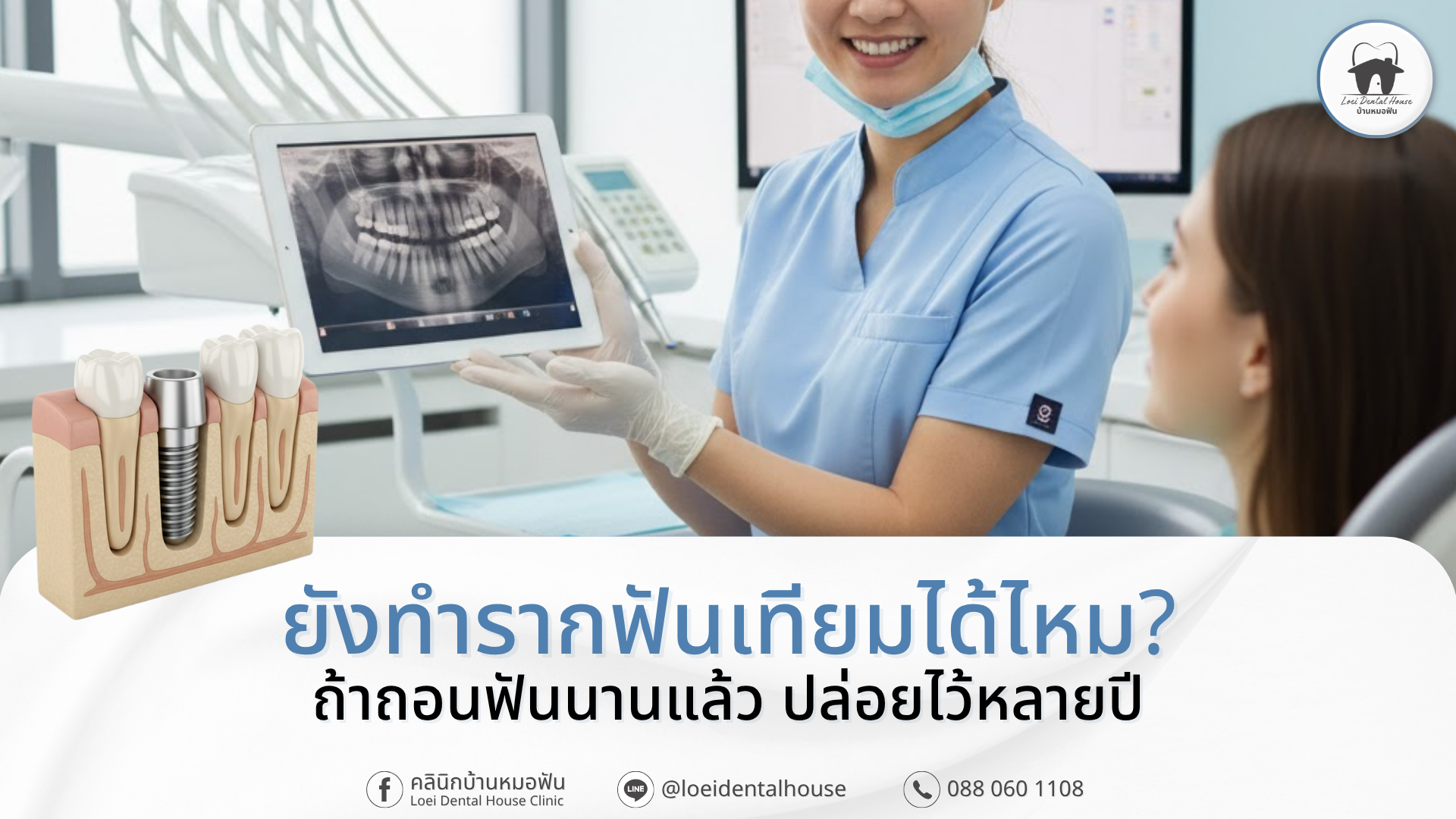 ทำรากฟันเทียม เลย