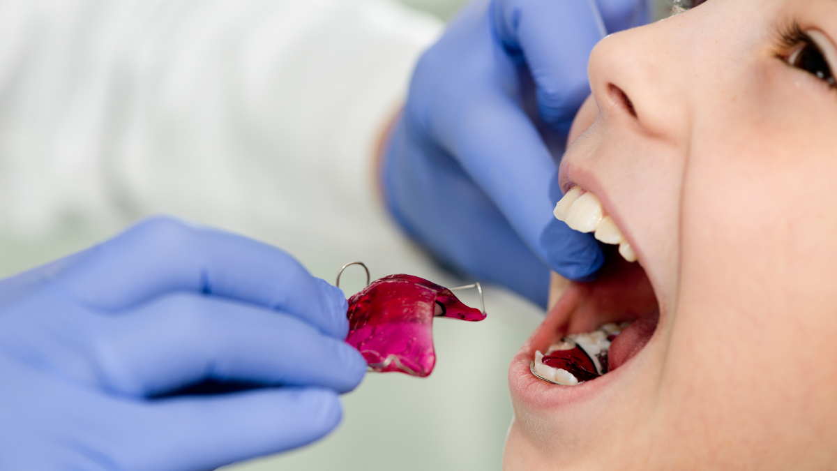 Are there any negative effects of Orthodontics for children Are there any negative effects of Orthodontics for children