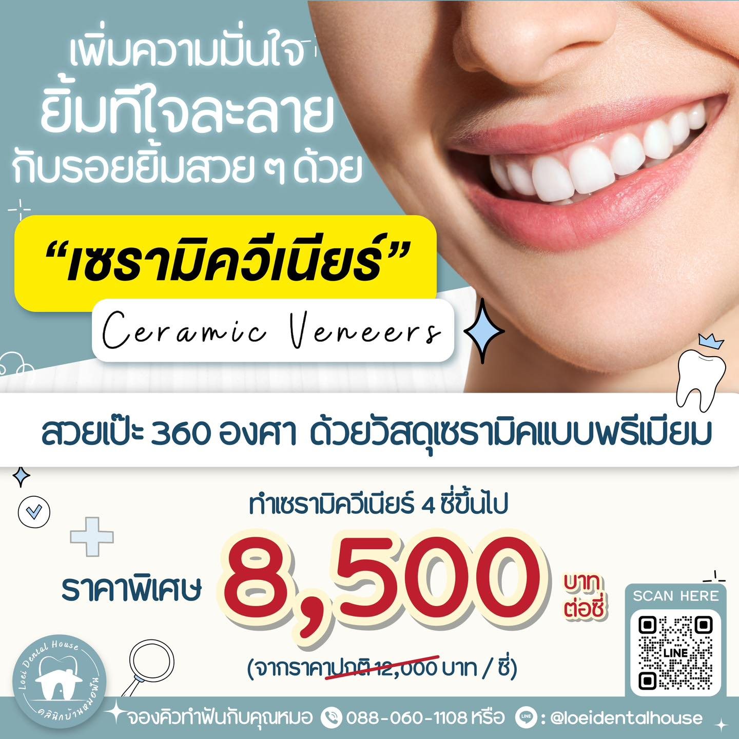 เซรามิควีเนียร์ (Ceramic Veneers)