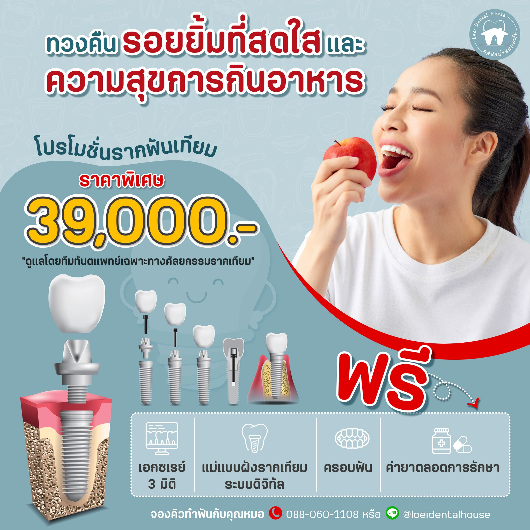 บริการทำ “รากฟันเทียม” เต็มรูปแบบ
