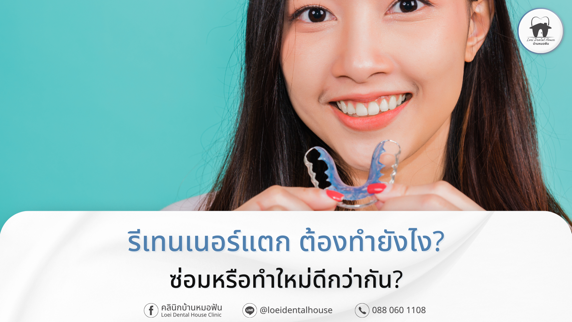 รีเทนเนอร์แตก ต้องทำยังไง_ ซ่อมหรือทำใหม่ดีกว่ากัน