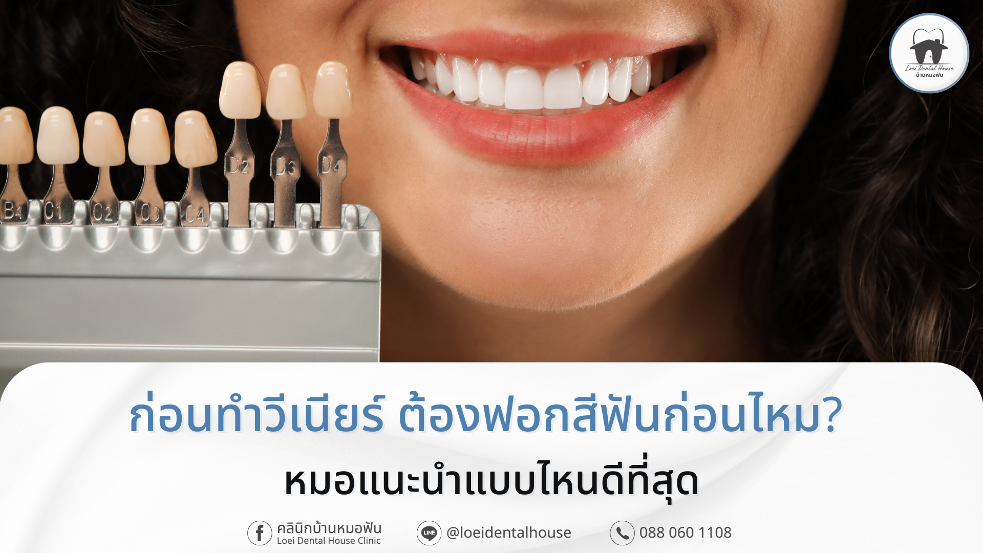 ก่อนทำวีเนียร์ ต้องฟอกสีฟันก่อนไหม_ หมอแนะนำแบบไหนดีที่สุด