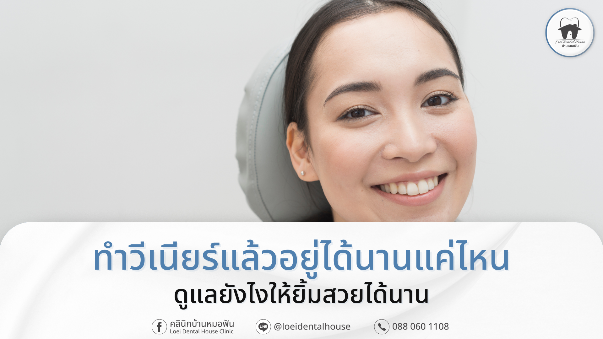 ทำวีเนียร์แล้วอยู่ได้นานแค่ไหน
