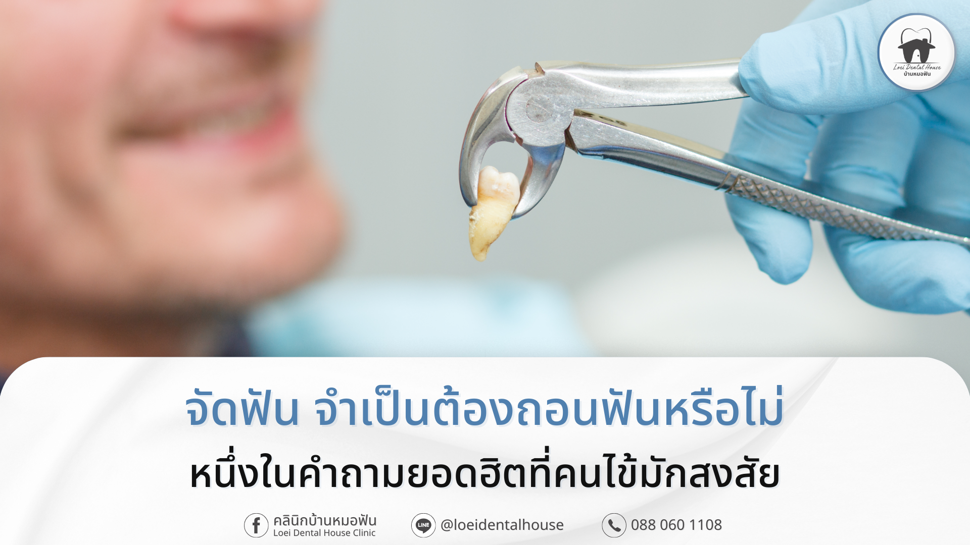 จัดฟัน จำเป็นต้องถอนฟันหรือไม่