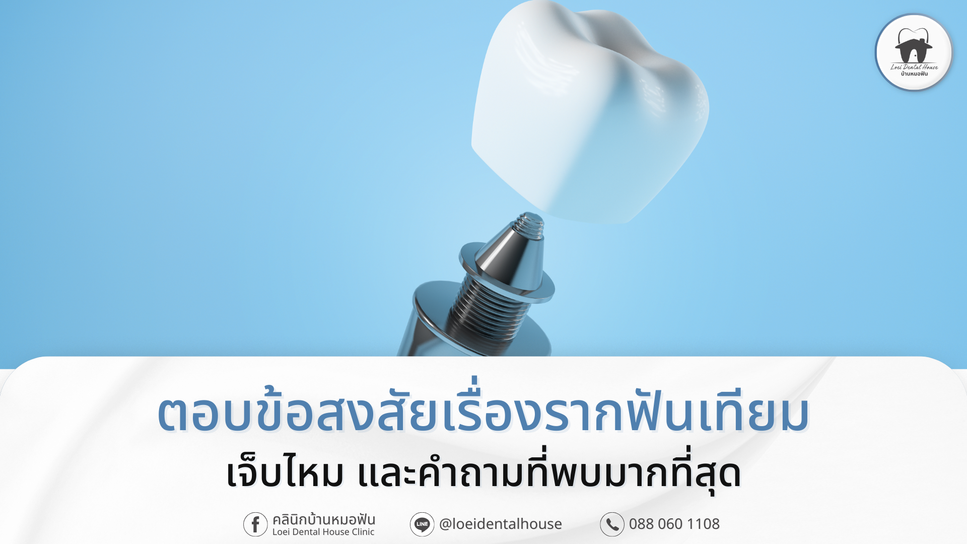 ตอบข้อสงสัยเรื่องรากฟันเทียม เจ็บไหม และคำถามที่พบมากที่สุด