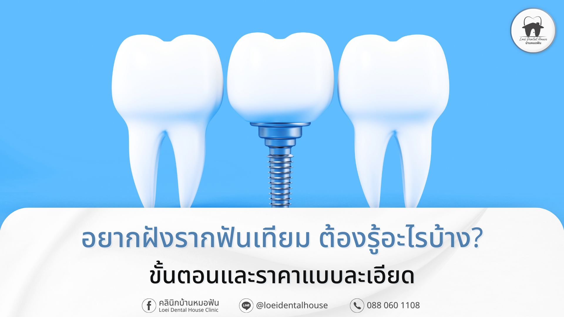 อยากฝังรากฟันเทียม ต้องรู้อะไรบ้าง