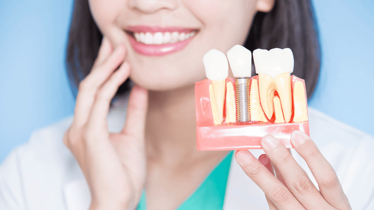 What are dental implants