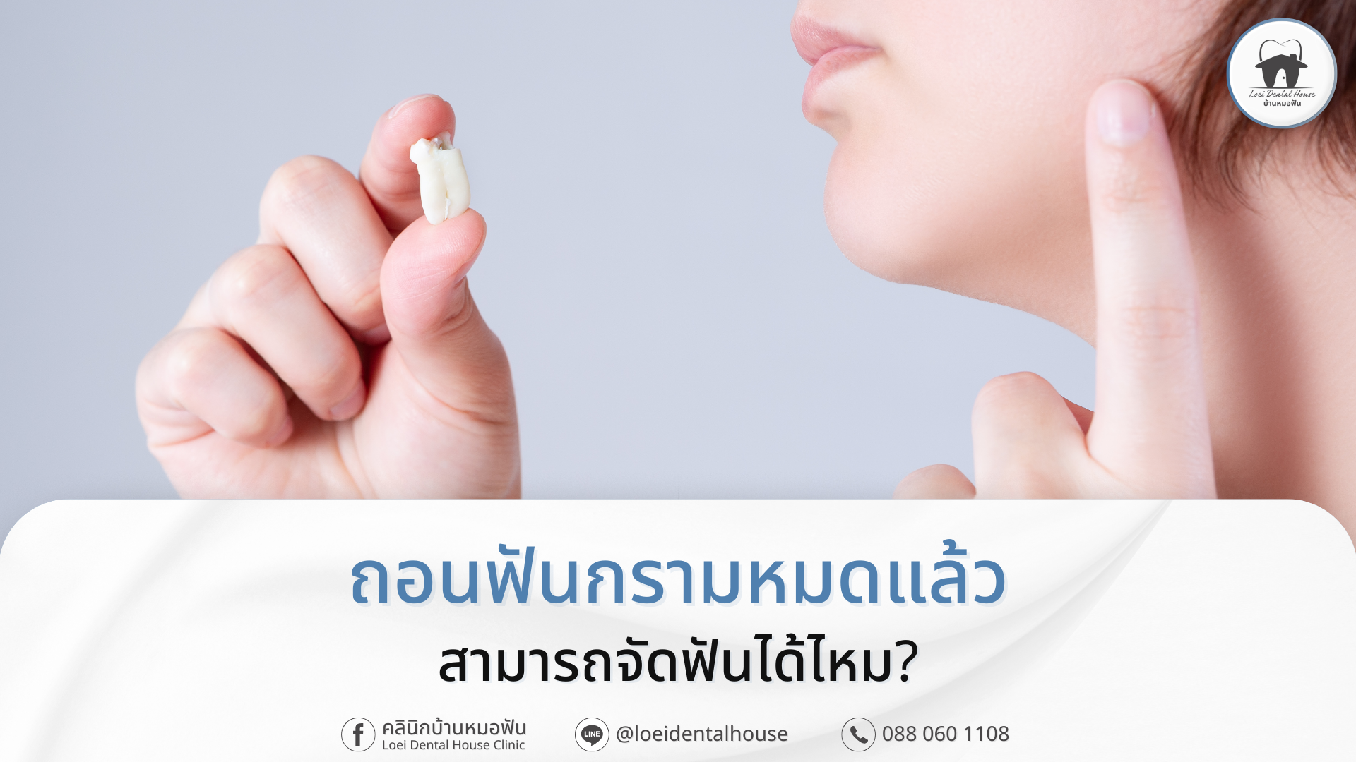 ถอนฟันกราม