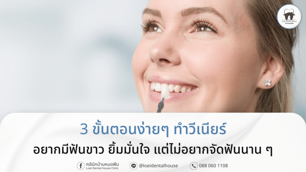 3 ขั้นตอนง่ายๆ ทำวีเนียร์ ทำแล้วฟันขาวสวย