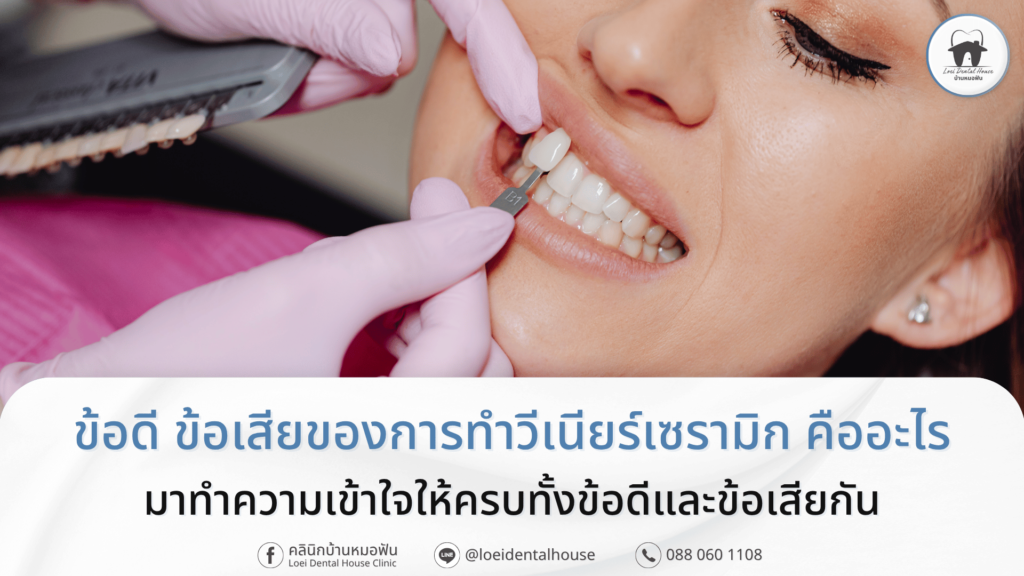 ข้อดี ข้อเสียของการทำวีเนียร์เซรามิก คืออะไร ทำไมได้รับนิยม