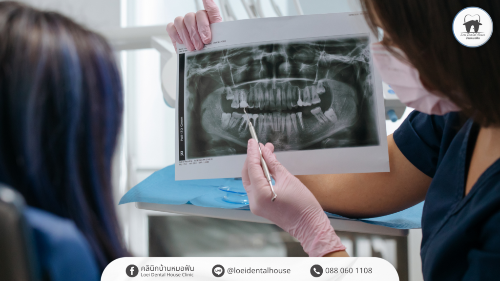 dental-implant-timeline-from-start-to-finish-2