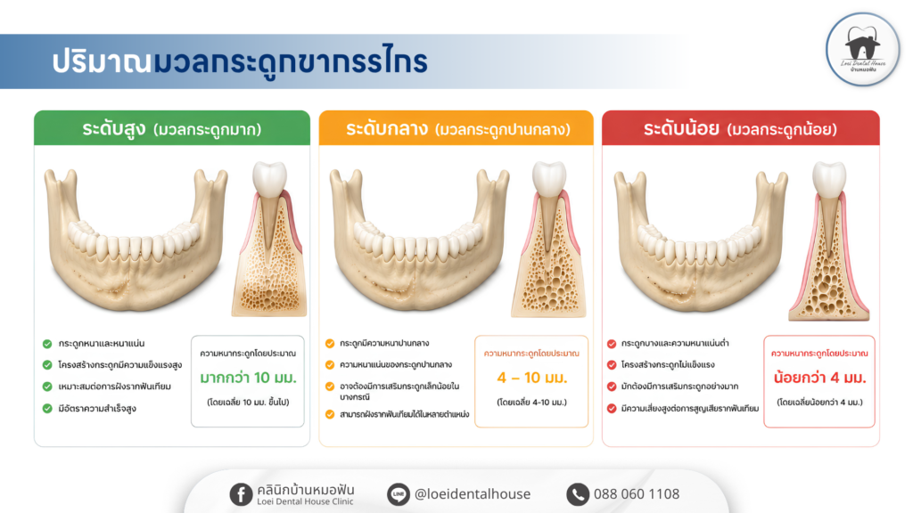 ระดับมวลกระดูกขากรรไกร