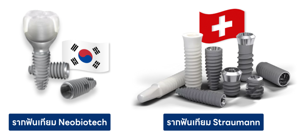 รากฟันเทียม Neobiotech และ รากฟันเทียม Straumann